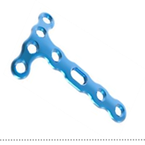 5.7 Distal Anterior Tibia Locking Compression Plate
